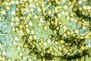 【フランス】微細藻類マイクロファイト、世界最大プラント建設。年100t。EUも20億円助成