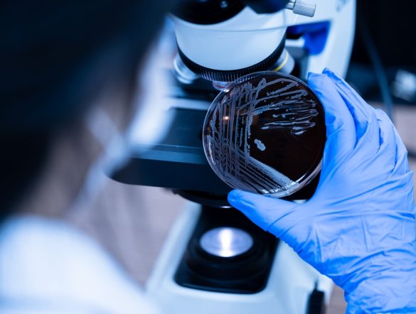 【イギリス】エディンバラ大等、廃PETからパーキンソン病治療薬製造。微生物変換